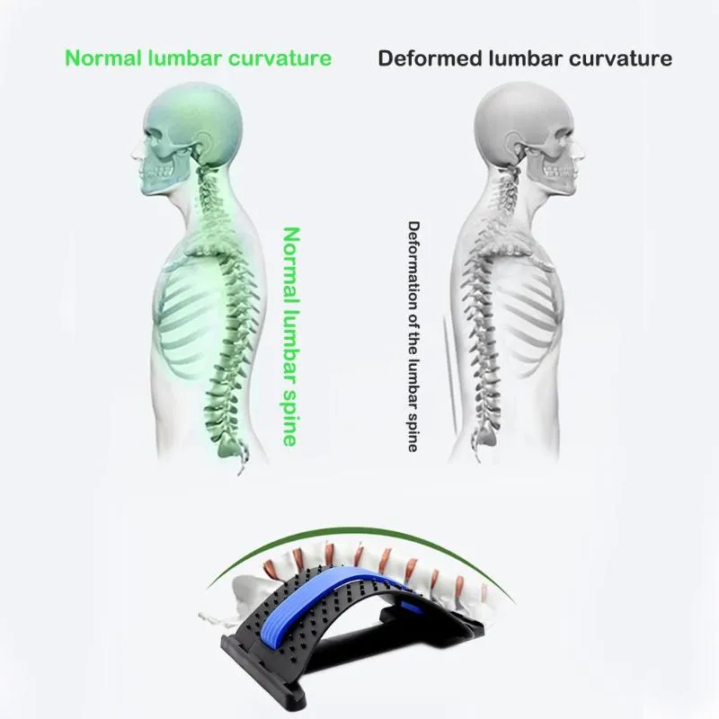 BACKRIGHT® LUMBAR RELIEF BACK STRETCHER - Back Stretch Equipment Massager Magic Stretcher Fitness Lumbar Support Relaxation Spine Pain Relief Corrector Health Care